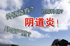 患上阴道炎的征兆有哪些