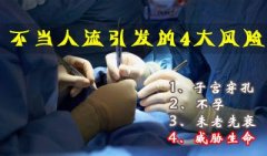无痛人流前要准备什么你知道吗