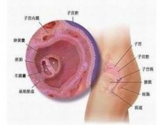焦作治疗附件炎哪个医院好